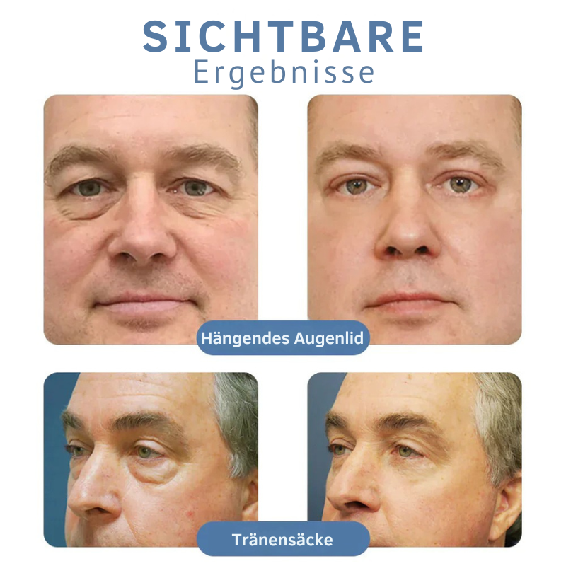 AugenBelebung™ Glatte Augenbehandlung (1+1 Gratis)