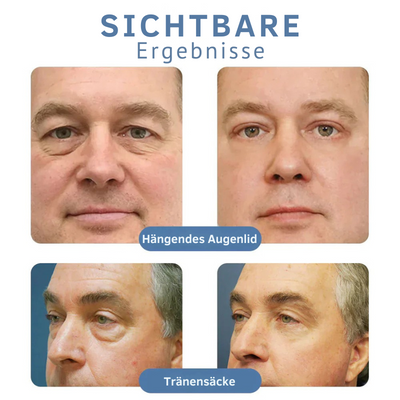 AugenBelebung™ Glatte Augenbehandlung (1+1 Gratis)