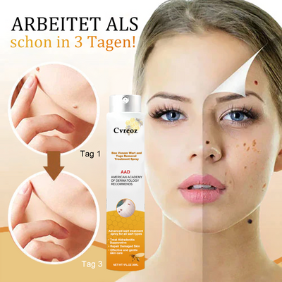 1+1 Gratis | Skin Free™ l Alle Flecken, Muttermale und Warzen werden innerhalb von 3 Tagen um 90% beseitigt!