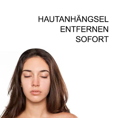 1+1 Gratis | Skin Free™ l Alle Flecken, Muttermale und Warzen werden innerhalb von 3 Tagen um 90% beseitigt!