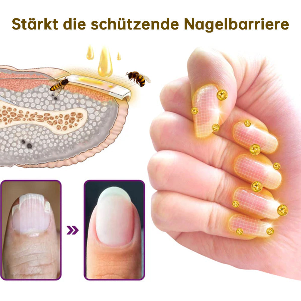 1+1 GRATIS | PilzSchutzschild™ Beseitigt Nagelpilz