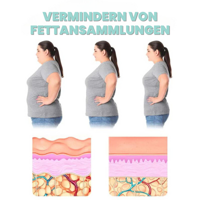 (1+1 Gratis) Fettabbau™ | Verlieren Sie 67% Fett innerhalb von 3 Tagen!