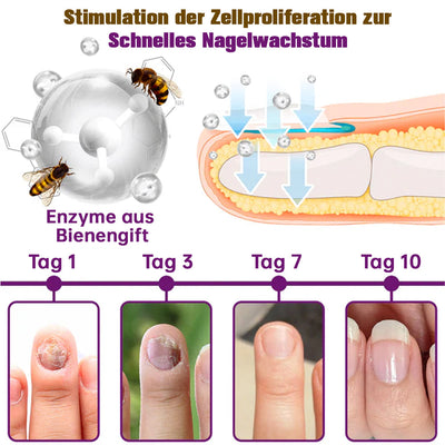 1+1 GRATIS | PilzSchutzschild™ Beseitigt Nagelpilz