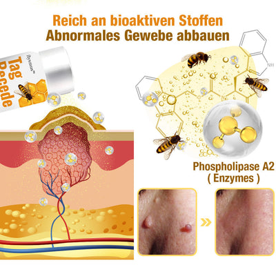 HonigHeilen™ Tag Recede Bienengift Behandlung Spray