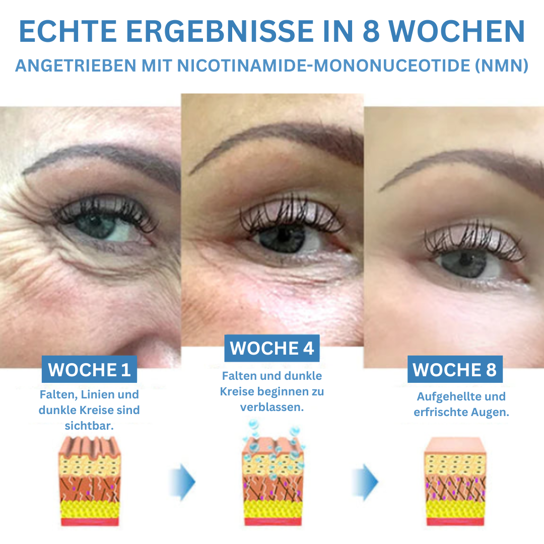 LeuchtendeAugen™ Augensackentferner und straffende Creme (1+1 gratis)