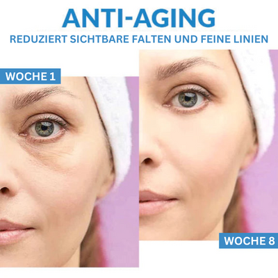 LeuchtendeAugen™ Augensackentferner und straffende Creme (1+1 gratis)